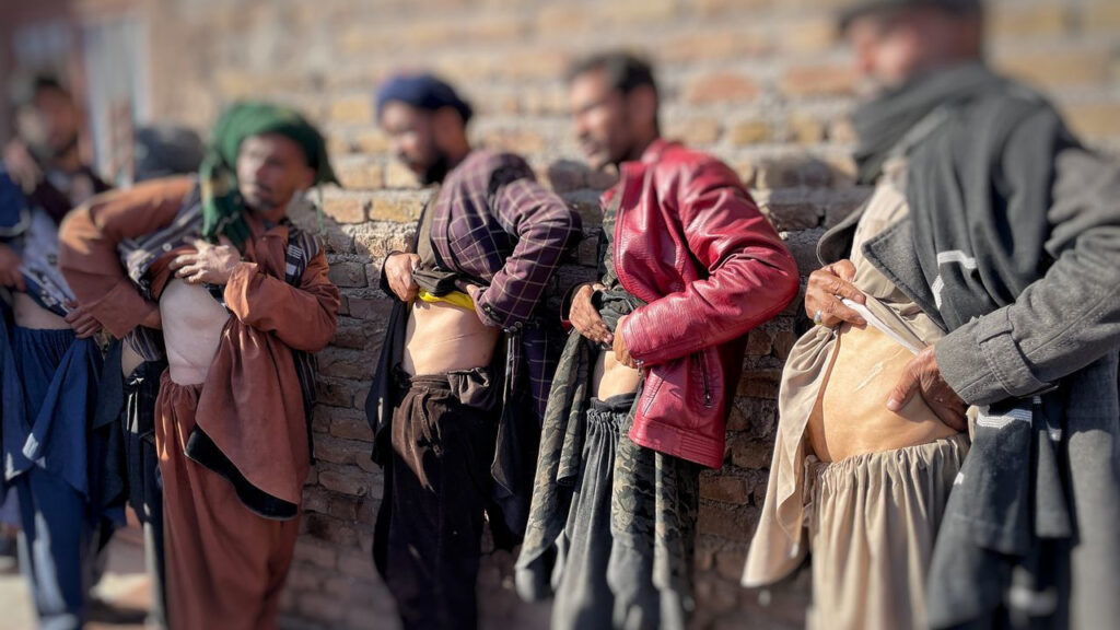 Afghans showing their scars- Straightnews